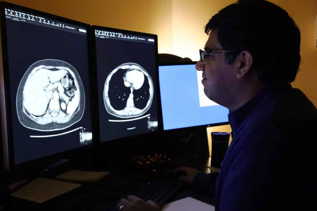 A radiologist looks at diagnostic images on a screen